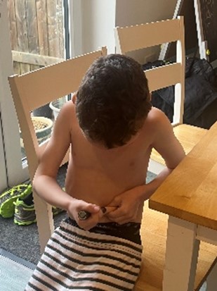 Jack giving his own injection one week after diagnosis